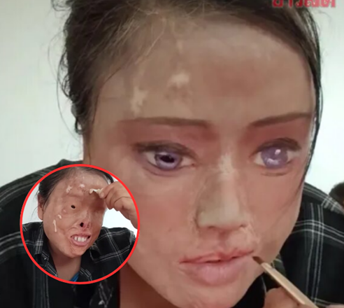 สาวจีนถูกอดีตสามีสาดกรด ฮึดสู้วาดใบหน้าใหม่ พลิกชีวิตจากเหยื่อสู่ อินฟลูเอนเซอร์ชื่อดัง