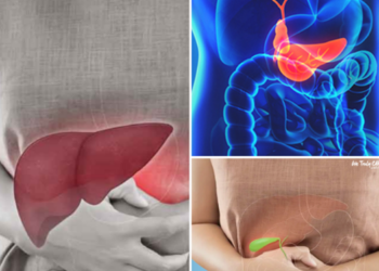 รีบเช็กก่อนสาย! ถ้ามีอาการแบบนี้ อย่าปล่อยผ่าน เสี่ยงมะเร็งตับ–ท่อน้ำดี